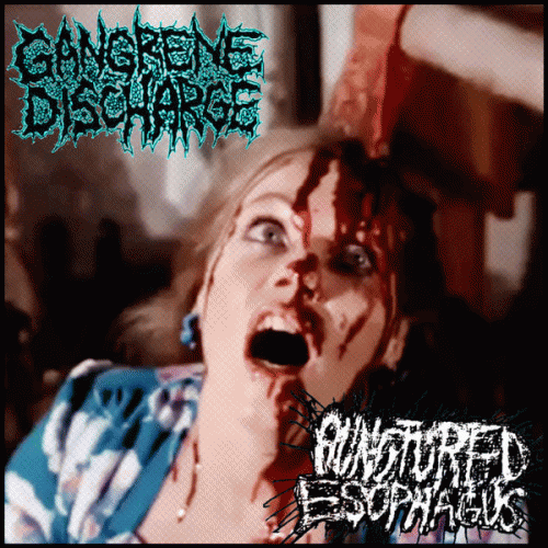 Gangrene Discharge : Gangrene Discharge - Punctured Esophagus